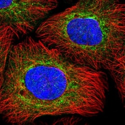 N-Acetylmannosamine Kinase/GNE Antibody, Novus Biologicals:Antibodies:Primary
